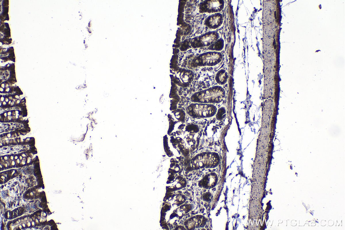 Immunohistochemistry (IHC) staining of rat colon tissue using ZIP kinase Polyclonal antibody (19540-1-AP)