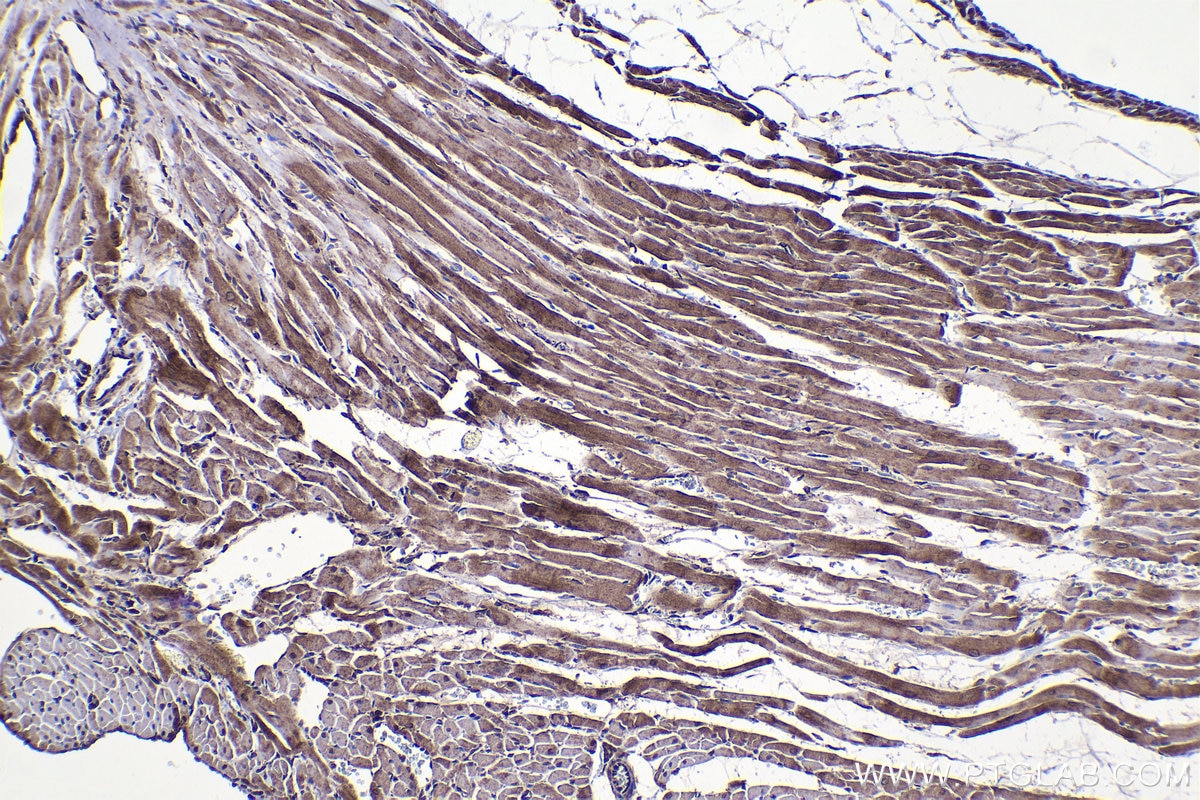 Immunohistochemistry (IHC) staining of rat heart tissue using ZIP kinase Polyclonal antibody (19540-1-AP)