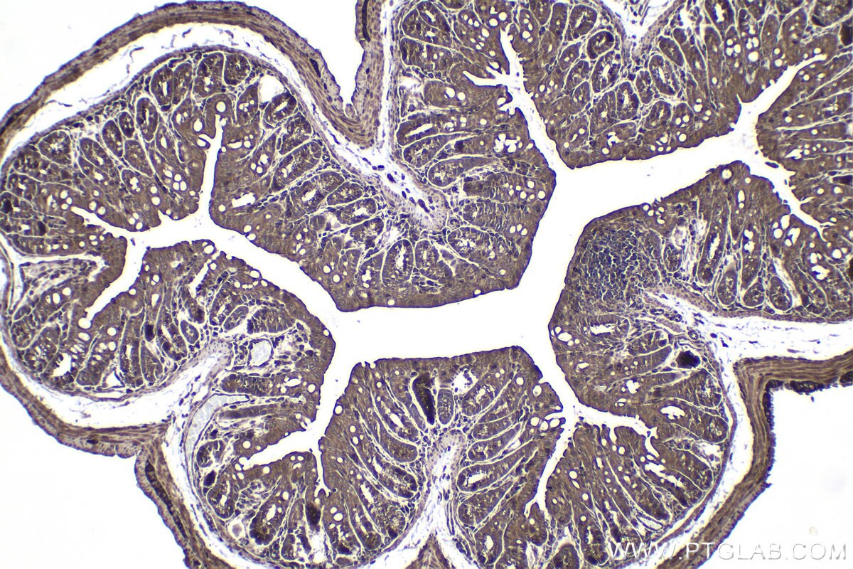 Immunohistochemistry (IHC) staining of mouse colon tissue using ZIP kinase Polyclonal antibody (19540-1-AP)