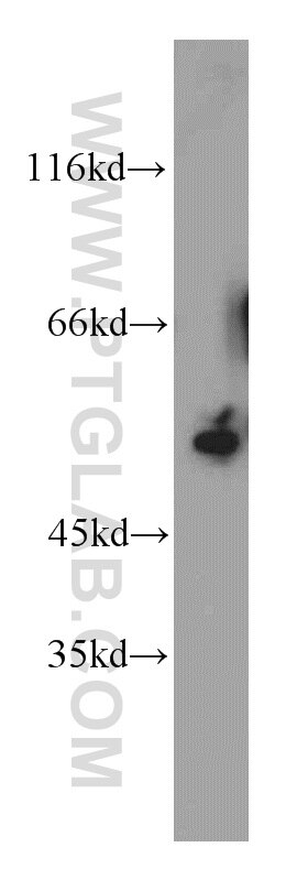 ZIP kinase