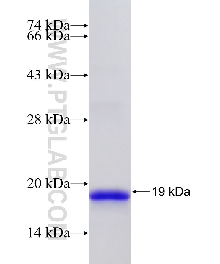 DAPK3 fusion protein Ag33051 SDS-PAGE