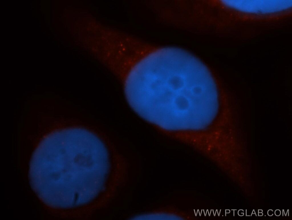 Immunofluorescence (IF) / fluorescent staining of HeLa cells using DAPP1 Polyclonal antibody (14722-1-AP)