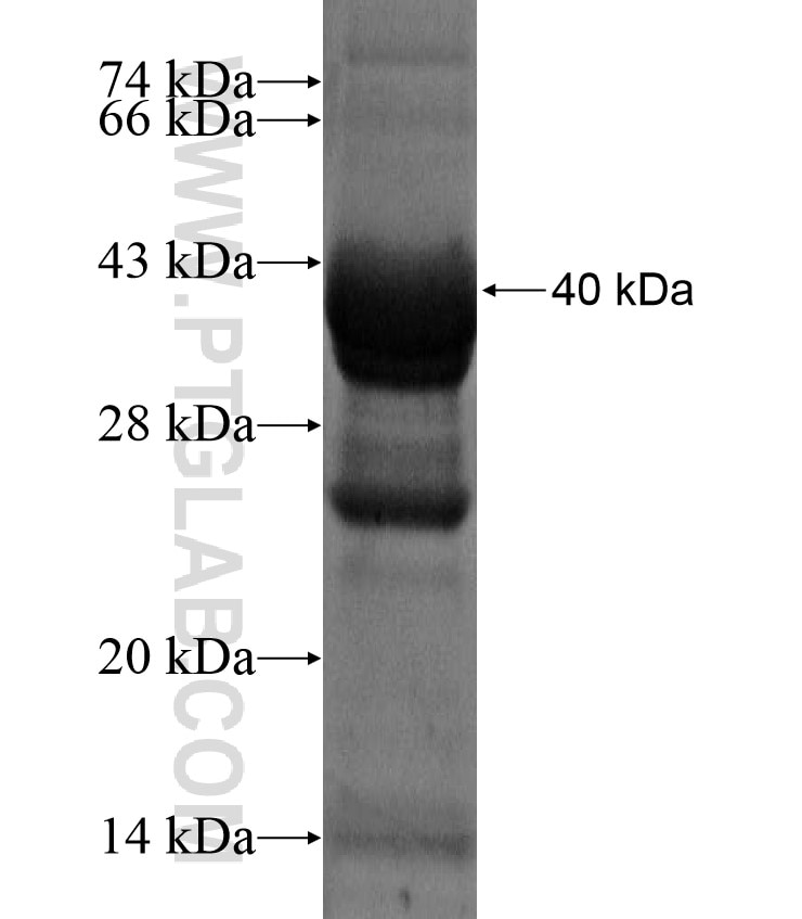 DARC fusion protein Ag17140 SDS-PAGE