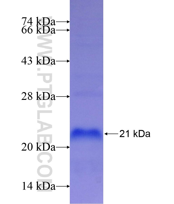 DARC fusion protein Ag17470 SDS-PAGE