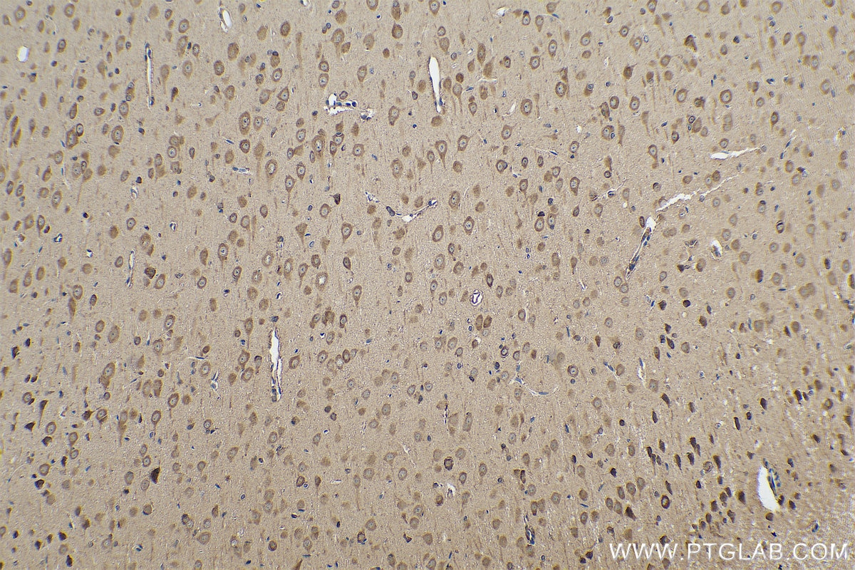 Immunohistochemistry (IHC) staining of rat brain tissue using DARS Polyclonal antibody (14989-1-AP)