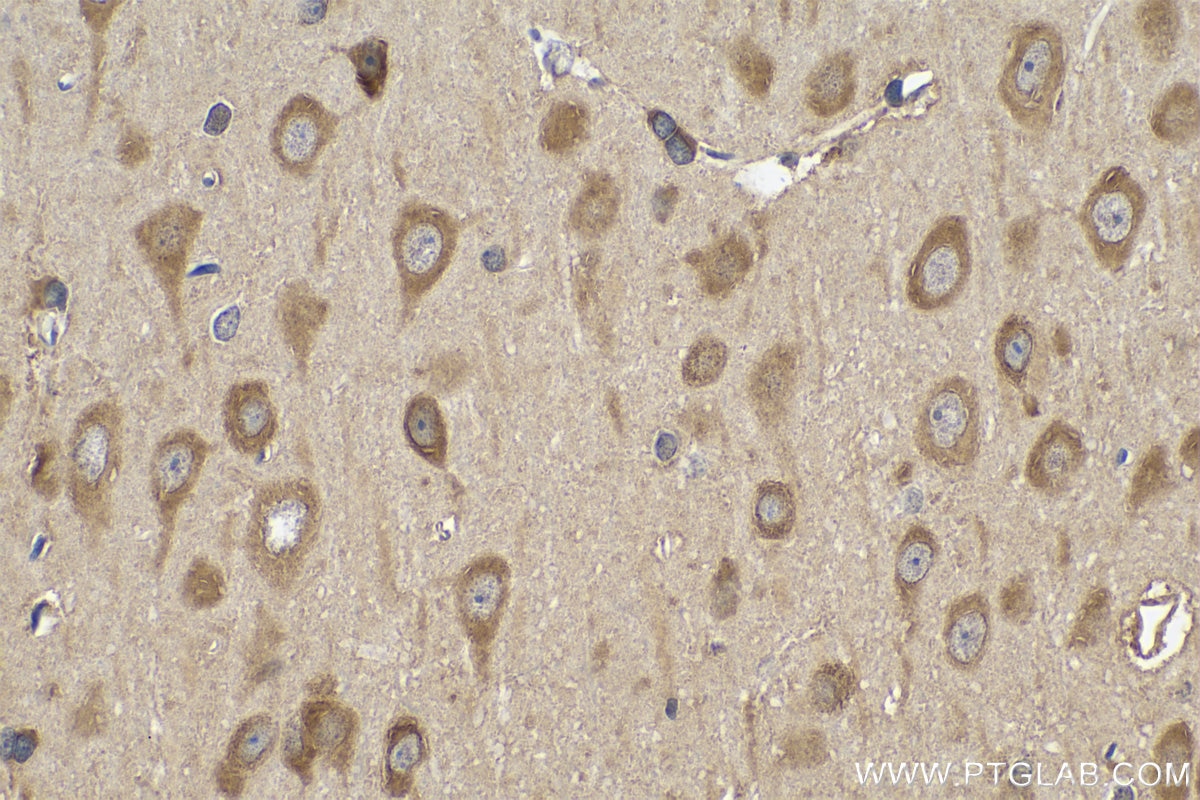 Immunohistochemistry (IHC) staining of rat brain tissue using DARS Polyclonal antibody (14989-1-AP)