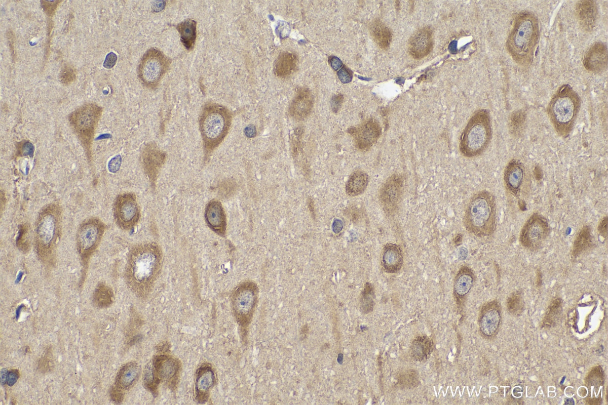 IHC staining of rat brain using 14989-1-AP