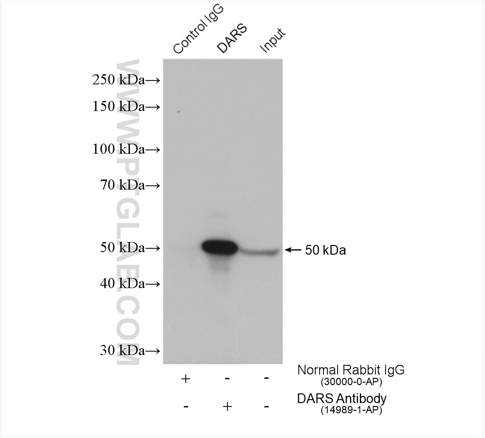 Immunoprecipitation (IP) experiment of HeLa cells using DARS Polyclonal antibody (14989-1-AP)