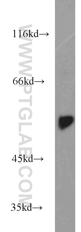 DARS Polyclonal antibody