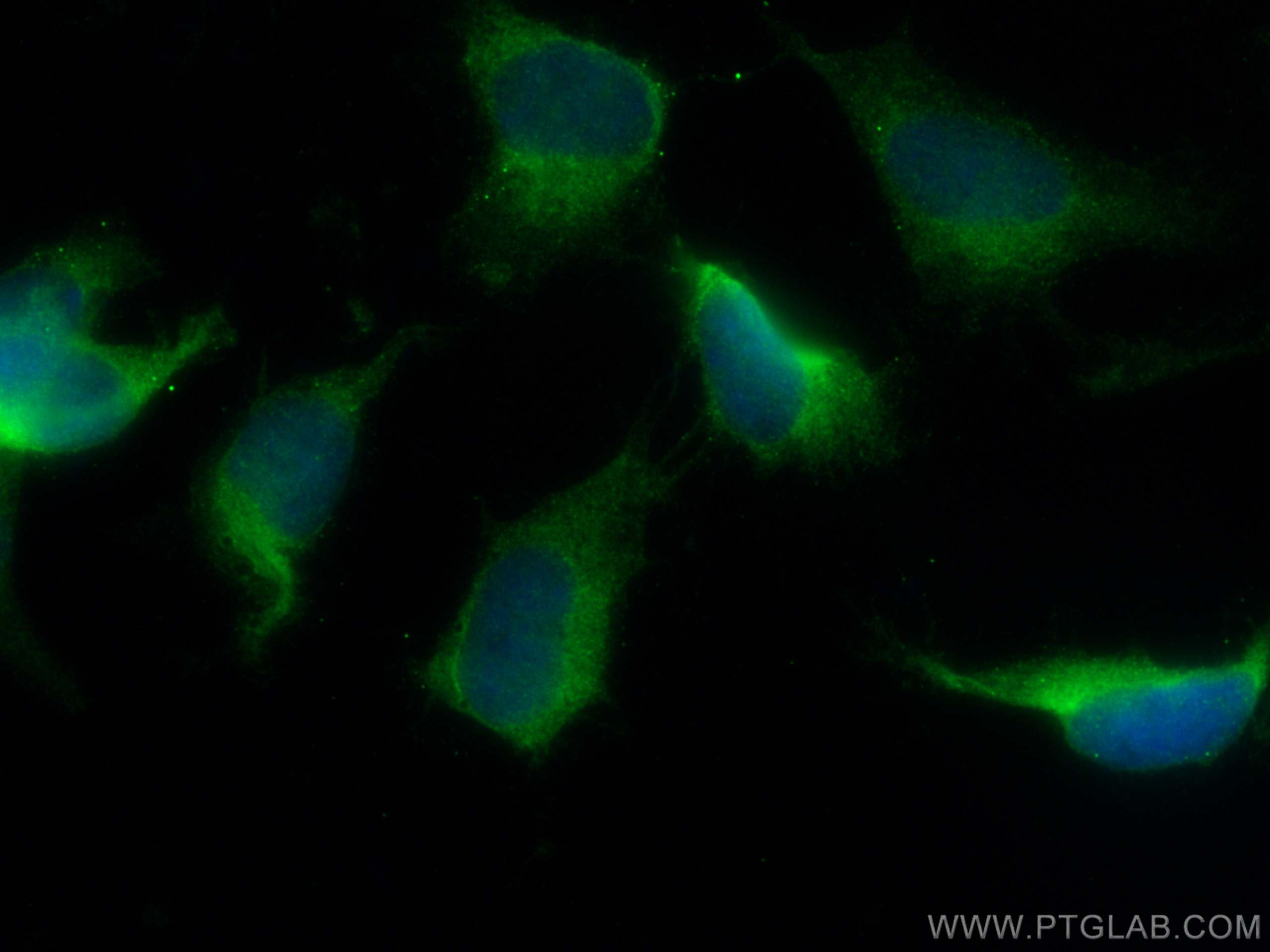Immunofluorescence (IF) / fluorescent staining of SH-SY5Y cells using DARS Monoclonal antibody (67930-1-Ig)