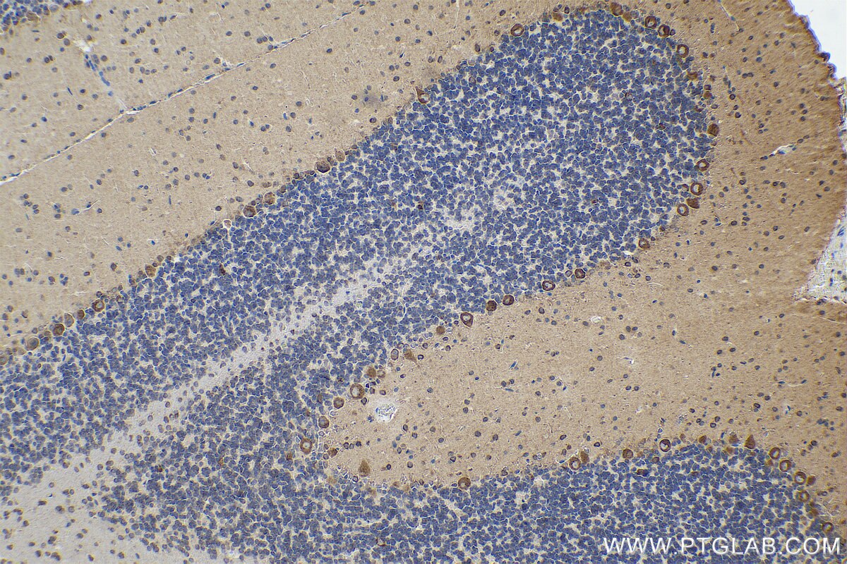 Immunohistochemistry (IHC) staining of rat cerebellum tissue using DARS Monoclonal antibody (67930-1-Ig)