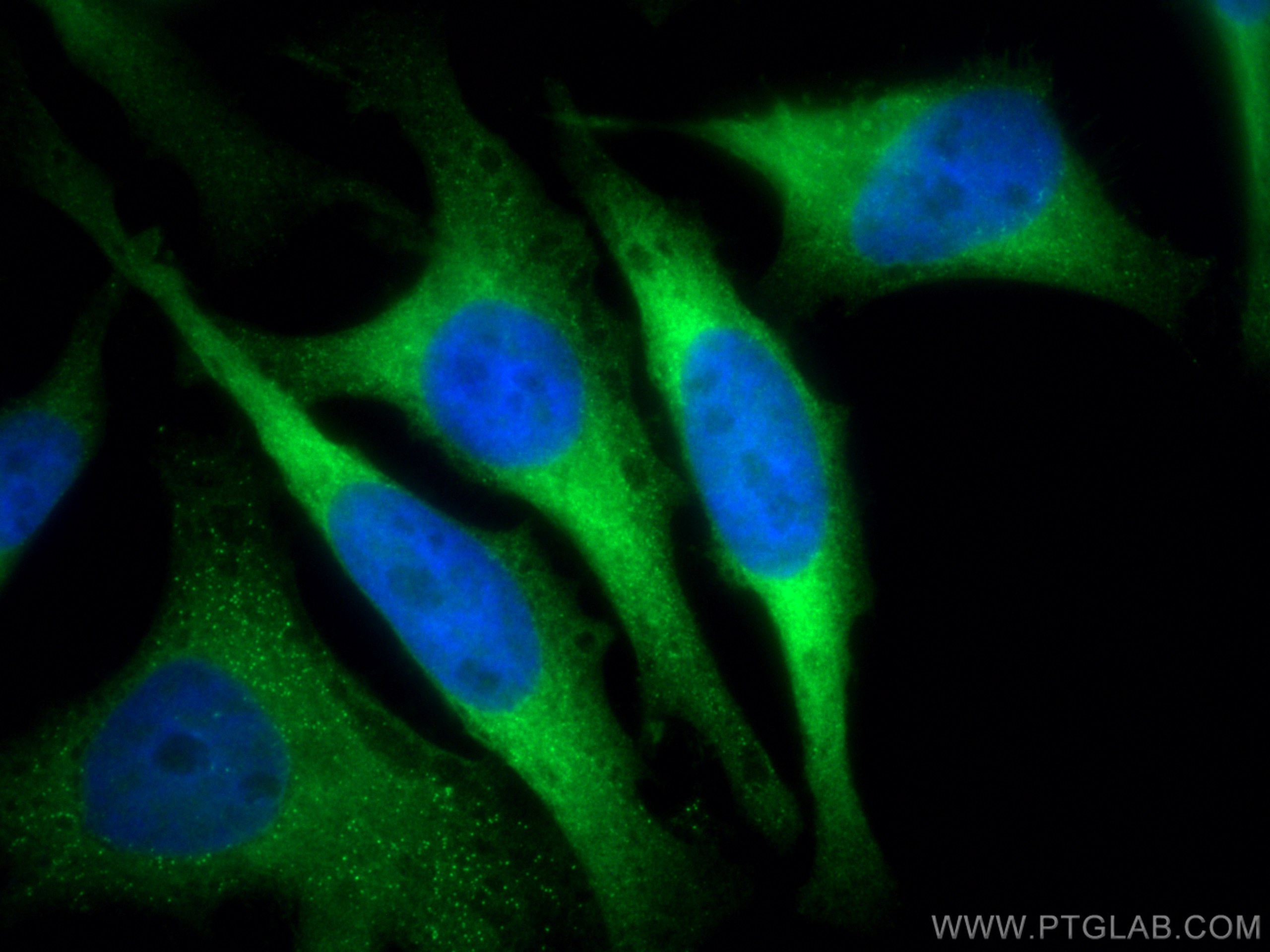 Immunofluorescence (IF) / fluorescent staining of HeLa cells using CoraLite® Plus 488-conjugated DARS Monoclonal anti (CL488-67930)
