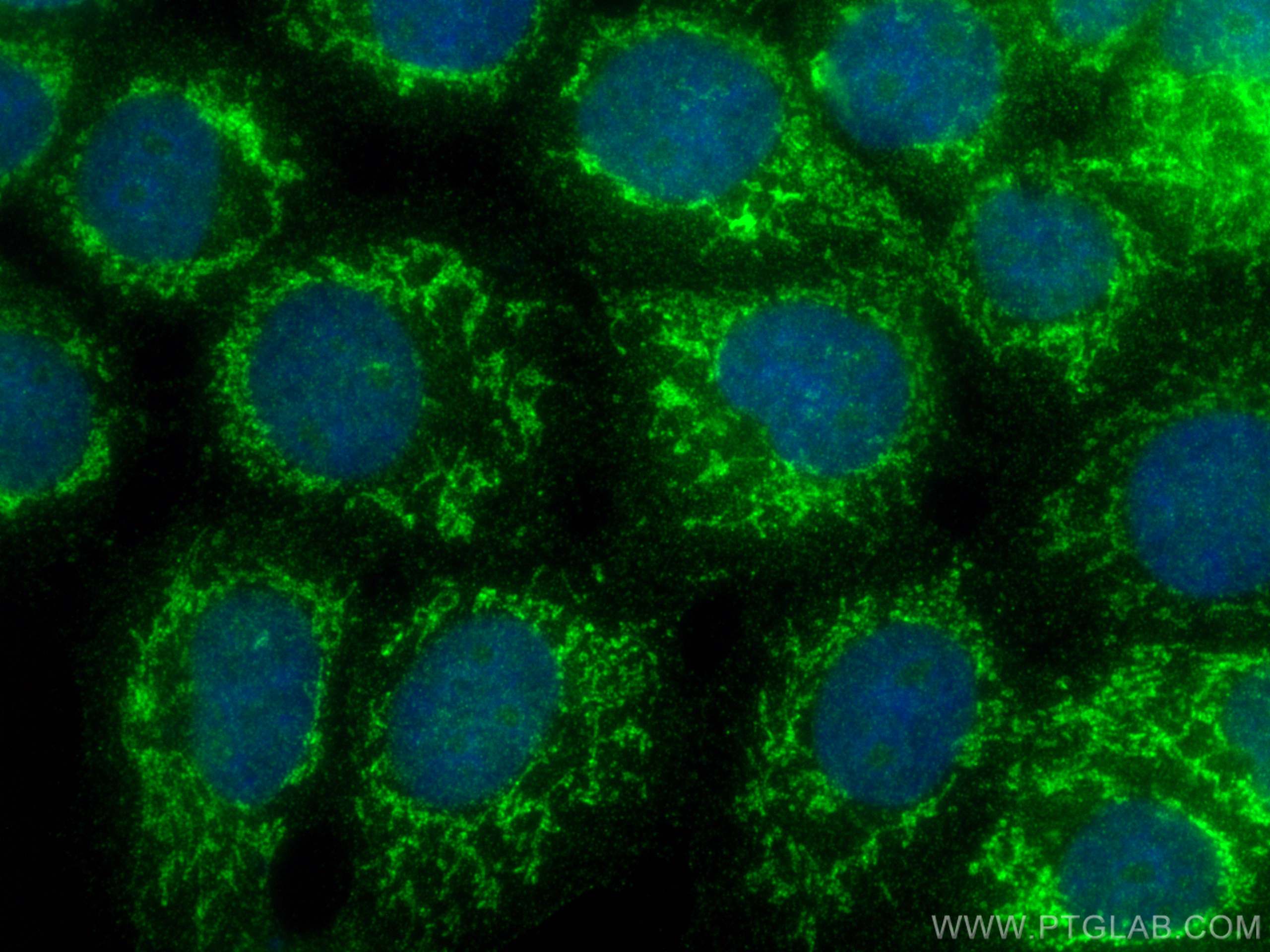 Immunofluorescence (IF) / fluorescent staining of A431 cells using DARS2 Polyclonal antibody (13807-1-AP)
