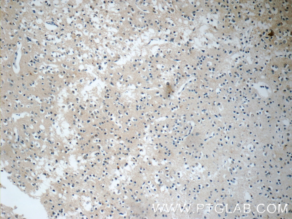 Immunohistochemistry (IHC) staining of human brain tissue using DARS2 Polyclonal antibody (13807-1-AP)