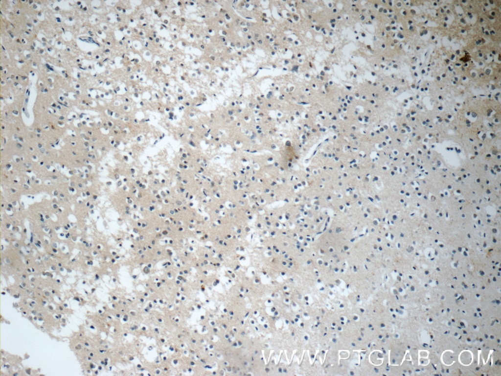 IHC staining of human brain using 13807-1-AP