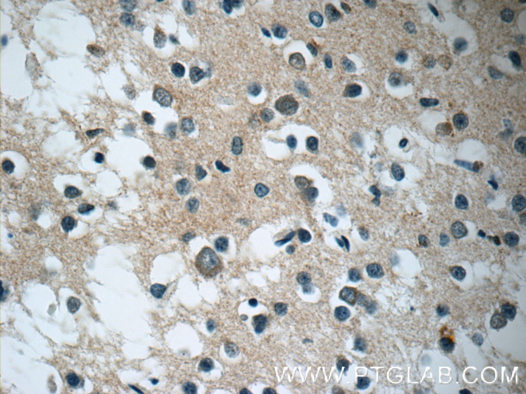 Immunohistochemistry (IHC) staining of human brain tissue using DARS2 Polyclonal antibody (13807-1-AP)