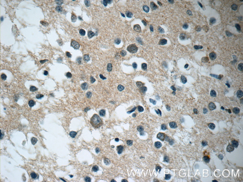 IHC staining of human brain using 13807-1-AP