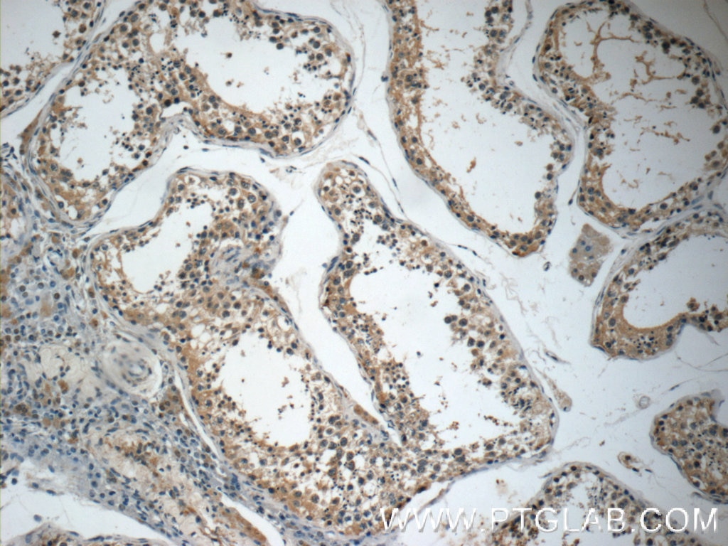 Immunohistochemistry (IHC) staining of human testis tissue using DARS2 Polyclonal antibody (13807-1-AP)