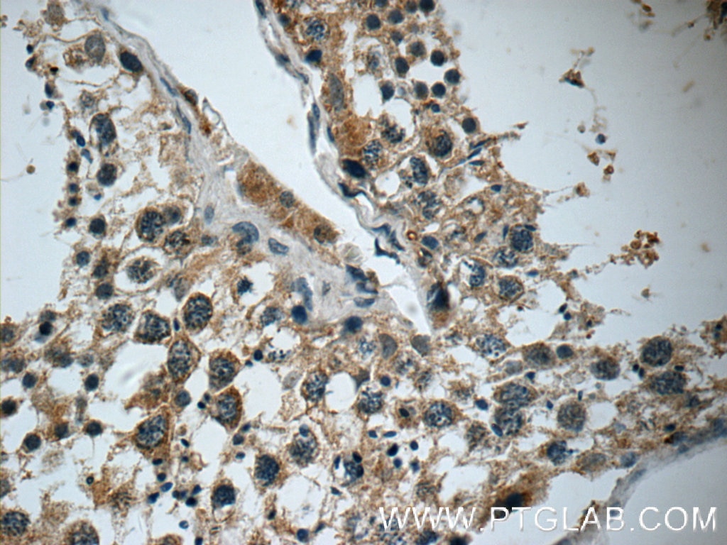 Immunohistochemistry (IHC) staining of human testis tissue using DARS2 Polyclonal antibody (13807-1-AP)