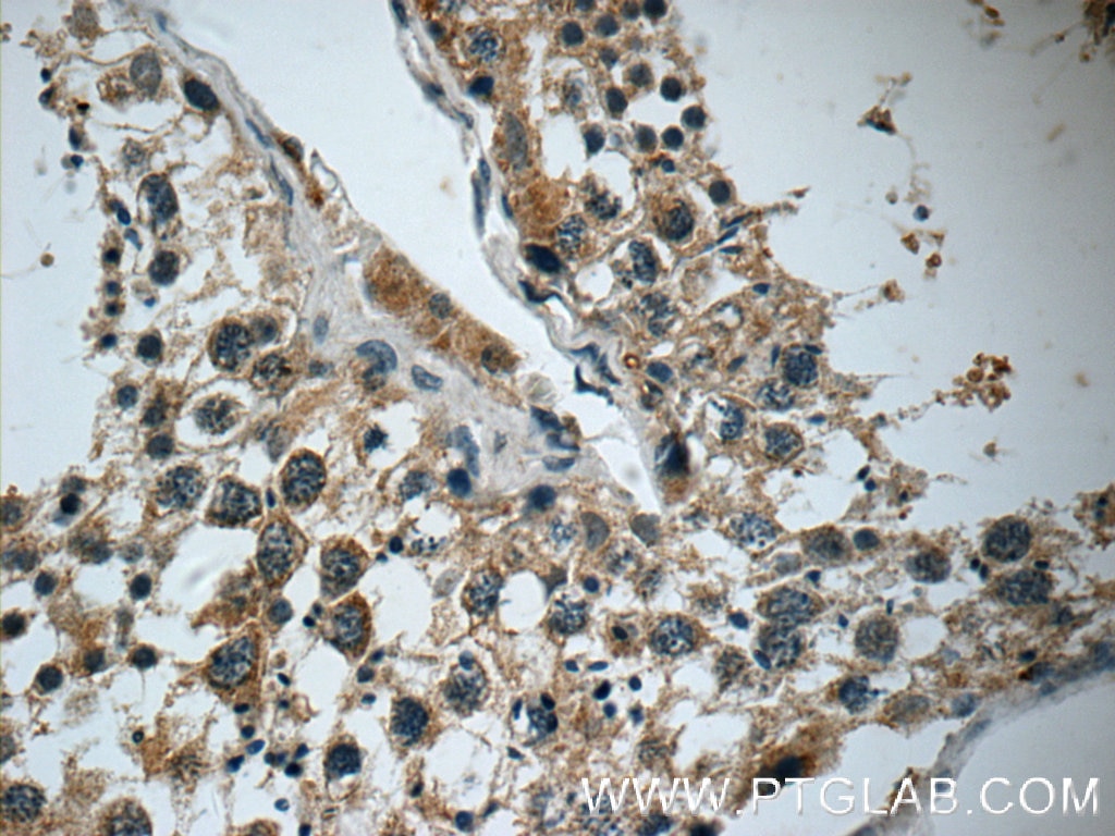 IHC staining of human testis using 13807-1-AP