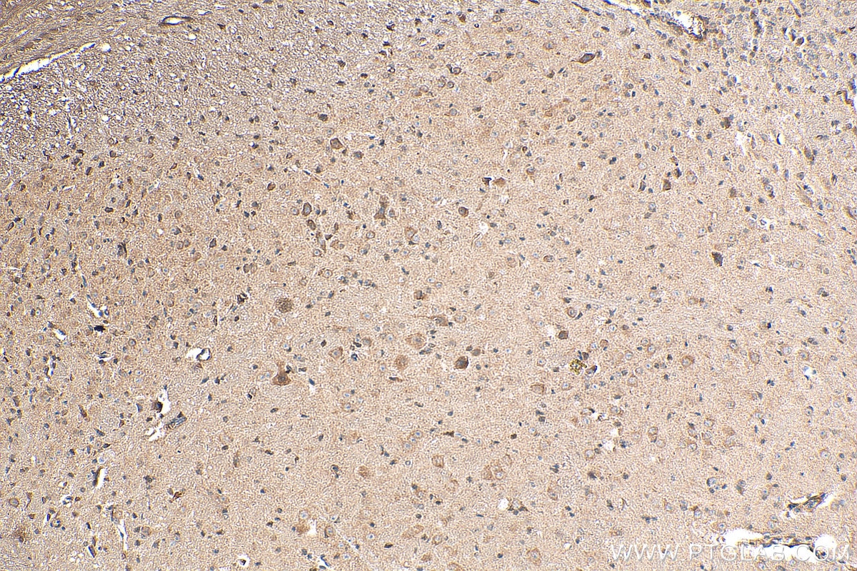 IHC staining of mouse cerebellum using 13807-1-AP