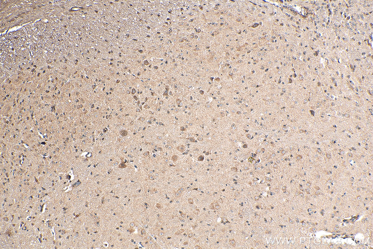 Immunohistochemistry (IHC) staining of mouse cerebellum tissue using DARS2 Polyclonal antibody (13807-1-AP)