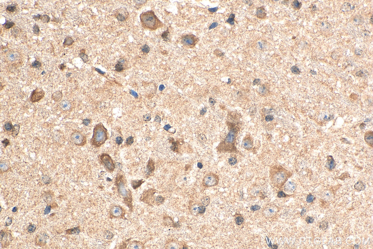 Immunohistochemistry (IHC) staining of mouse cerebellum tissue using DARS2 Polyclonal antibody (13807-1-AP)