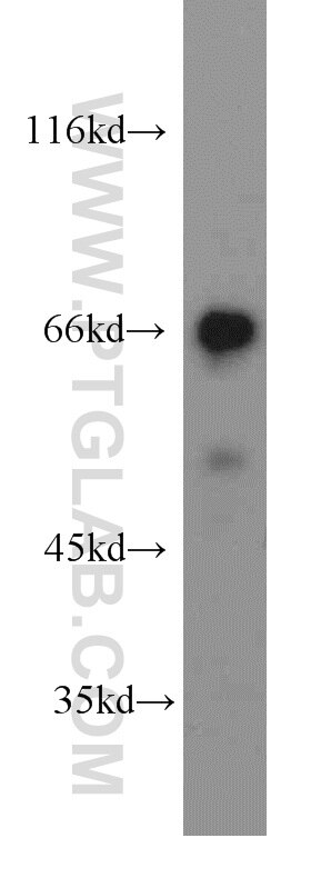 WB analysis of human placenta using 13807-1-AP