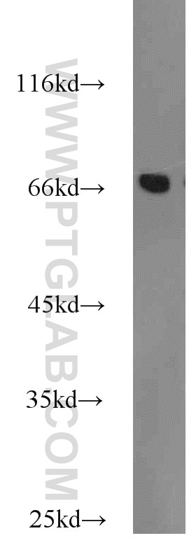Western Blot (WB) analysis of human placenta tissue using DARS2 Polyclonal antibody (13807-1-AP)