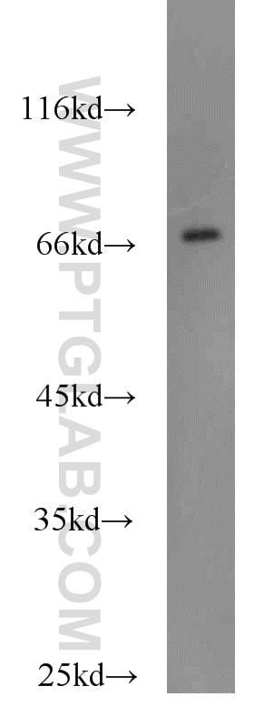 Western Blot (WB) analysis of human placenta tissue using DARS2 Polyclonal antibody (13807-1-AP)