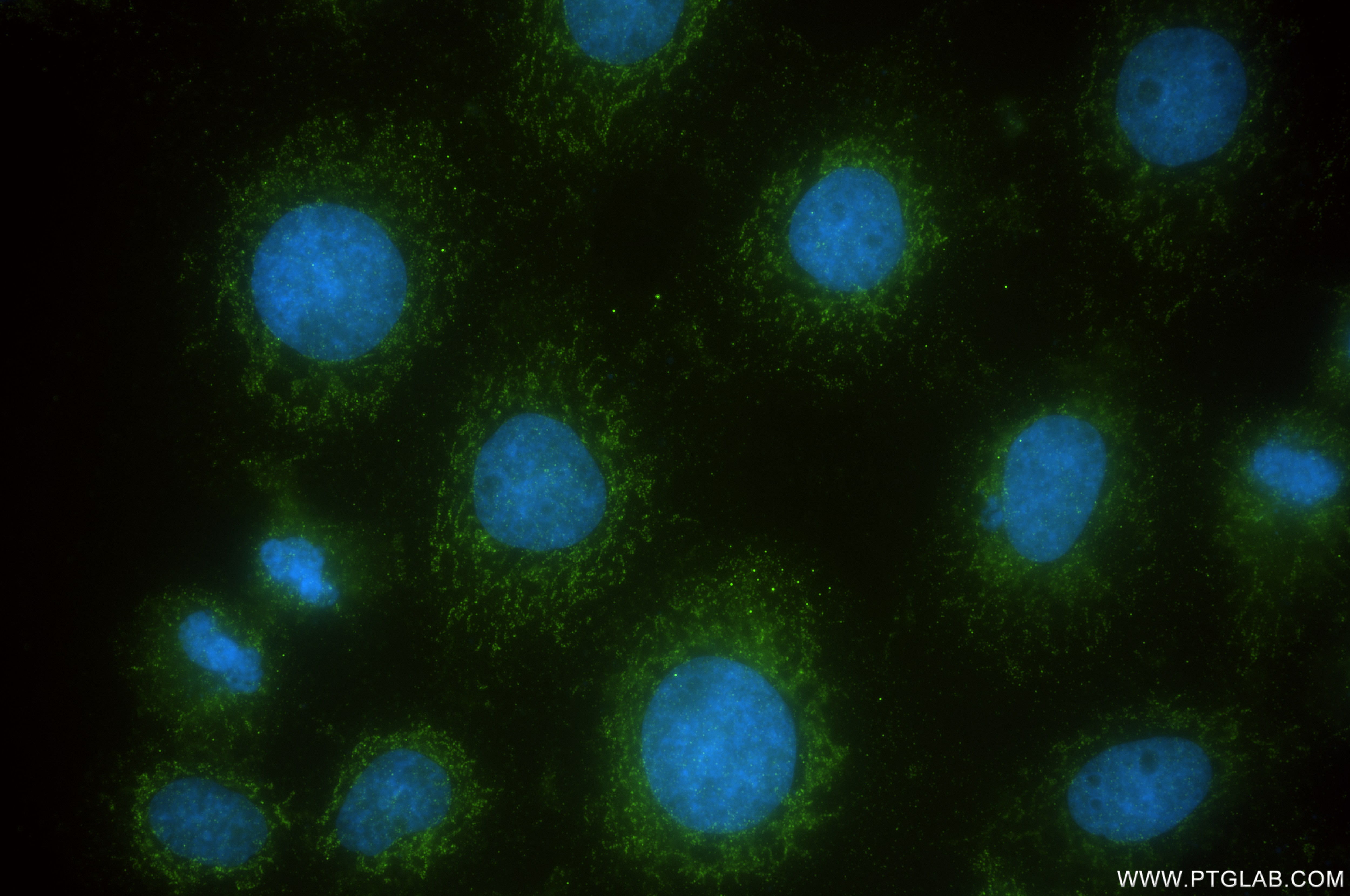 Immunofluorescence (IF) / fluorescent staining of A431 cells using DARS2 Recombinant antibody (85691-2-RR)