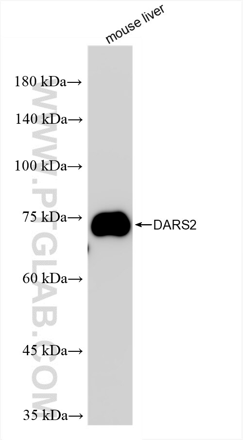 DARS2