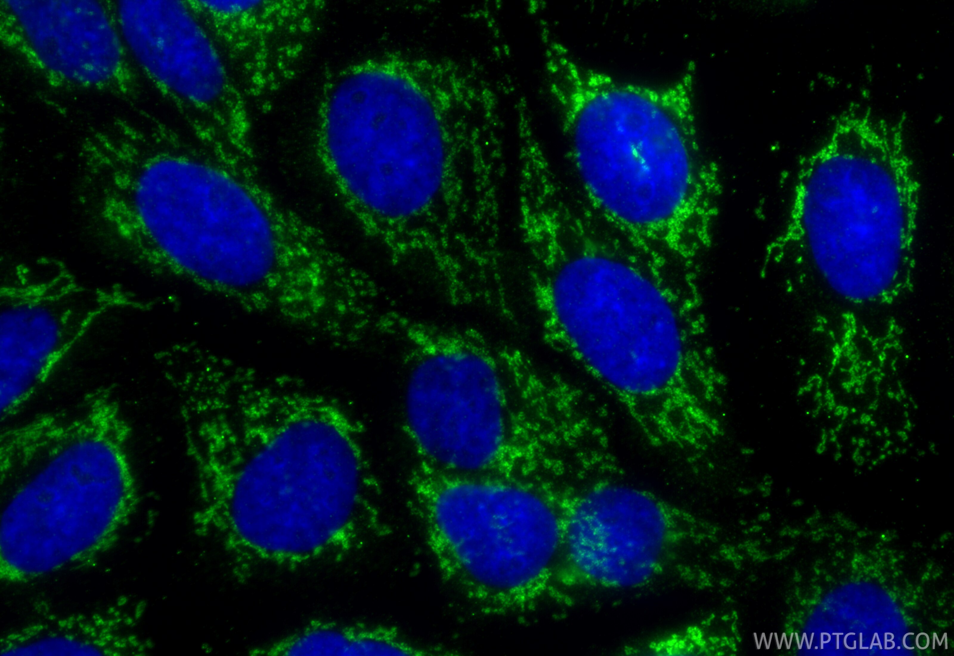 Immunofluorescent analysis of (-20°C Methanol) fixed A431 cells using DARS2 antibody (RMX00040) at dilution of 1:200 and CoraLite®488-Conjugated Goat Anti-Rabbit IgG(H+L) (SA00013-2). Immunofluorescence (IF) / fluorescent staining of A431 cells using Multi-rAb® DARS2 Multi-Recombinant antibody (RMX00040)