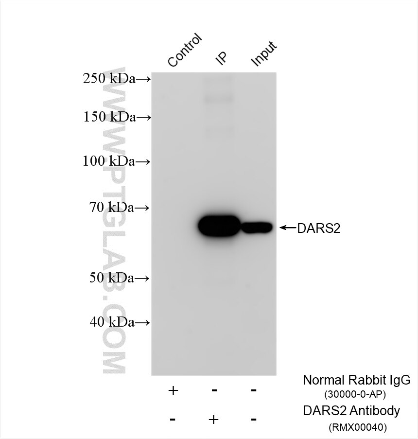 IP result of anti-DARS2 (IP:RMX00040, 4ug; Detection:RMX00040 1:10000) with A549 cells lysate 920 ug. Immunoprecipitation (IP) experiment of A549 cells using Multi-rAb® DARS2 Multi-Recombinant antibody (RMX00040)