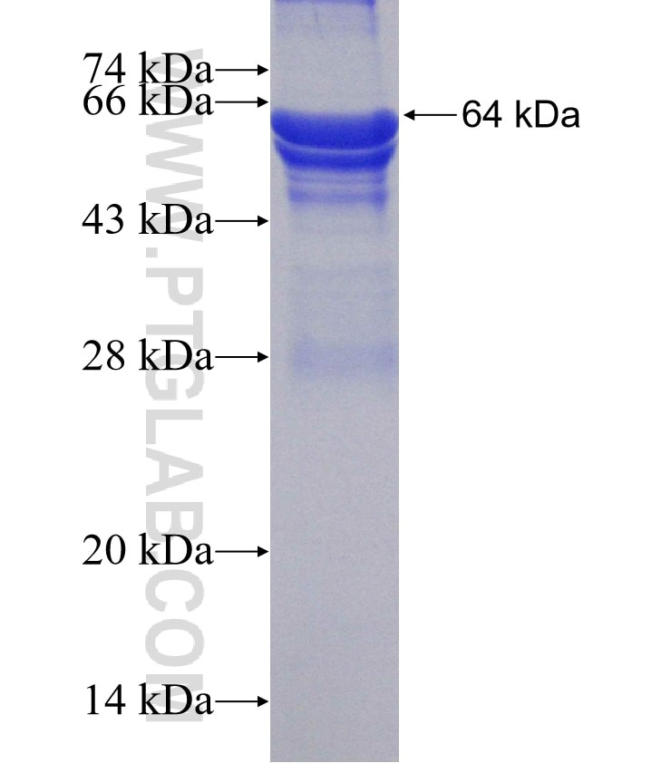 DARS2 fusion protein Ag4809 SDS-PAGE