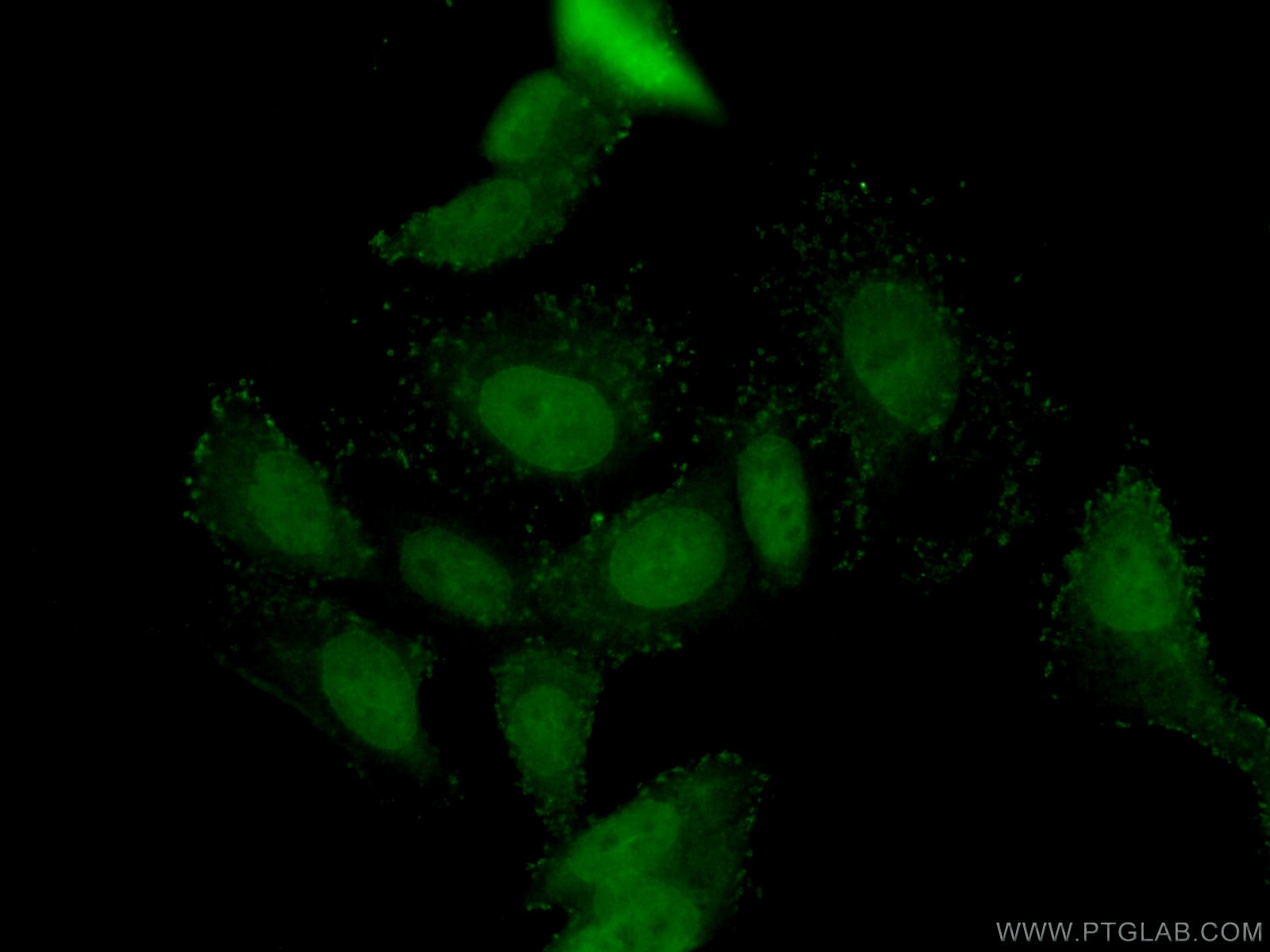 Immunofluorescence (IF) / fluorescent staining of MCF-7 cells using DAX-1 Polyclonal antibody (20849-1-AP)