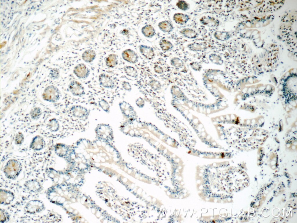 IHC staining of human small intestine using 20849-1-AP