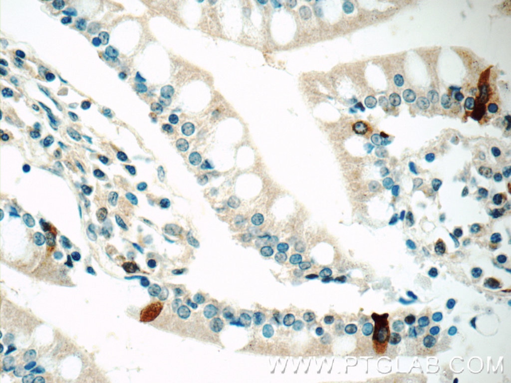 Immunohistochemistry (IHC) staining of human small intestine tissue using DAX-1 Polyclonal antibody (20849-1-AP)