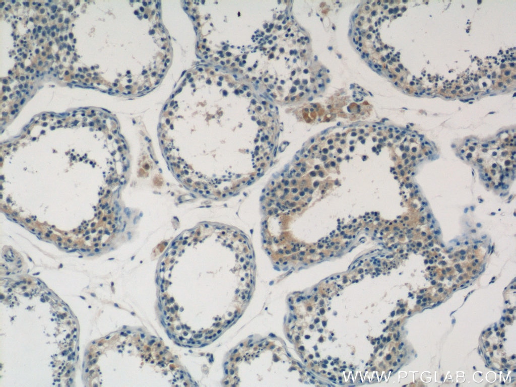 IHC staining of human testis using 20849-1-AP