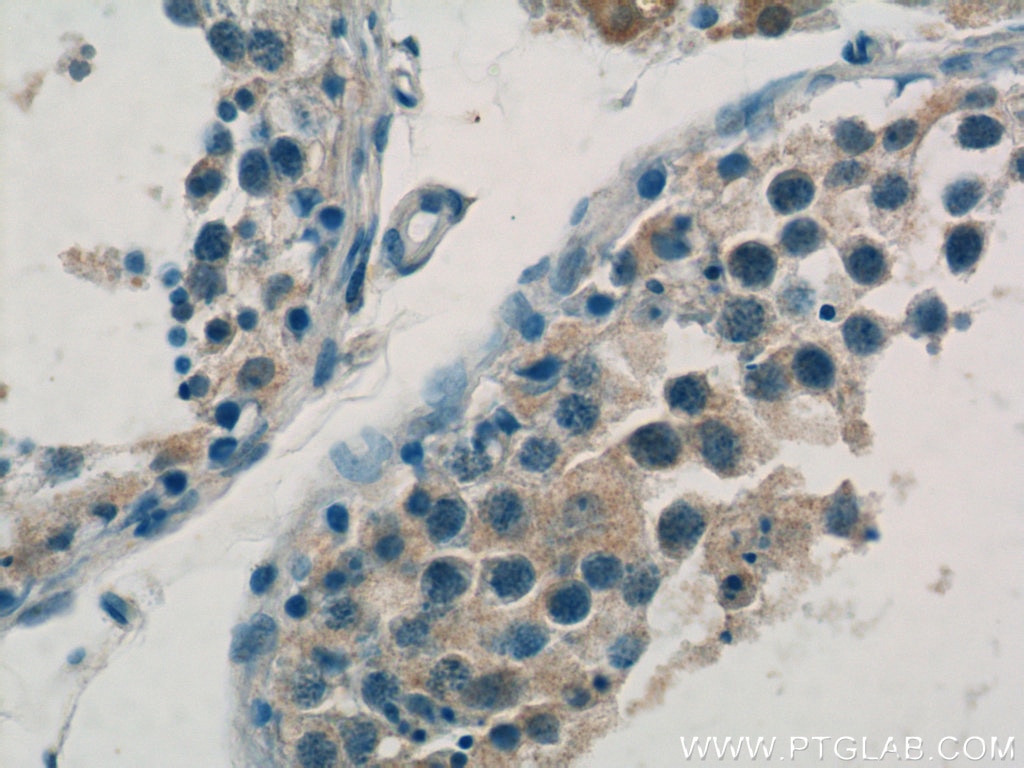 Immunohistochemistry (IHC) staining of human testis tissue using DAX-1 Polyclonal antibody (20849-1-AP)