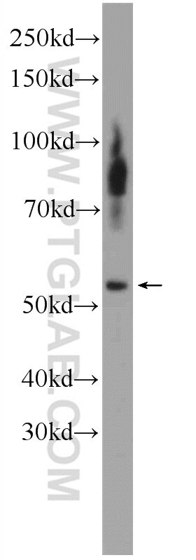 Western Blot (WB) analysis of MCF-7 cells using DAX-1 Polyclonal antibody (20849-1-AP)