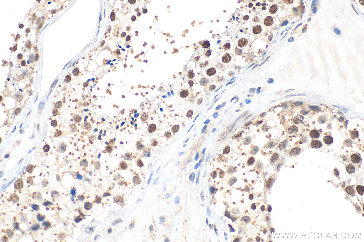 Immunohistochemistry (IHC) staining of human testis tissue using DAXX Polyclonal antibody (20489-1-AP)