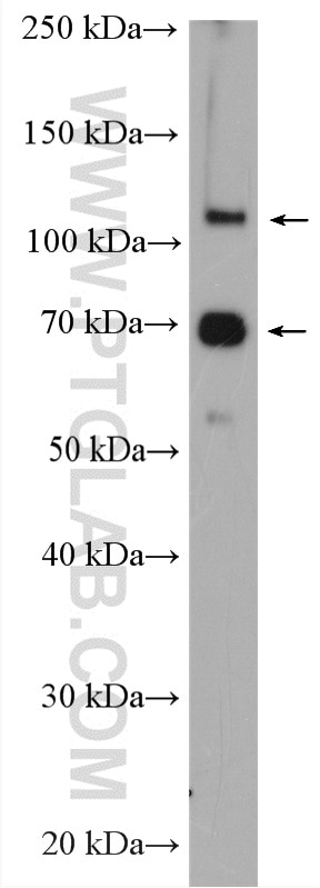 Western Blot (WB) analysis of Y79 cells using DAXX Polyclonal antibody (20489-1-AP)