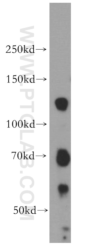 Western Blot (WB) analysis of HeLa cells using DAXX Polyclonal antibody (20489-1-AP)