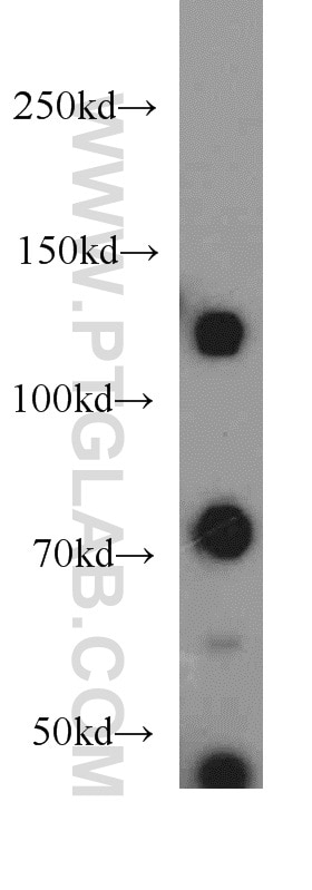 DAXX Polyclonal antibody