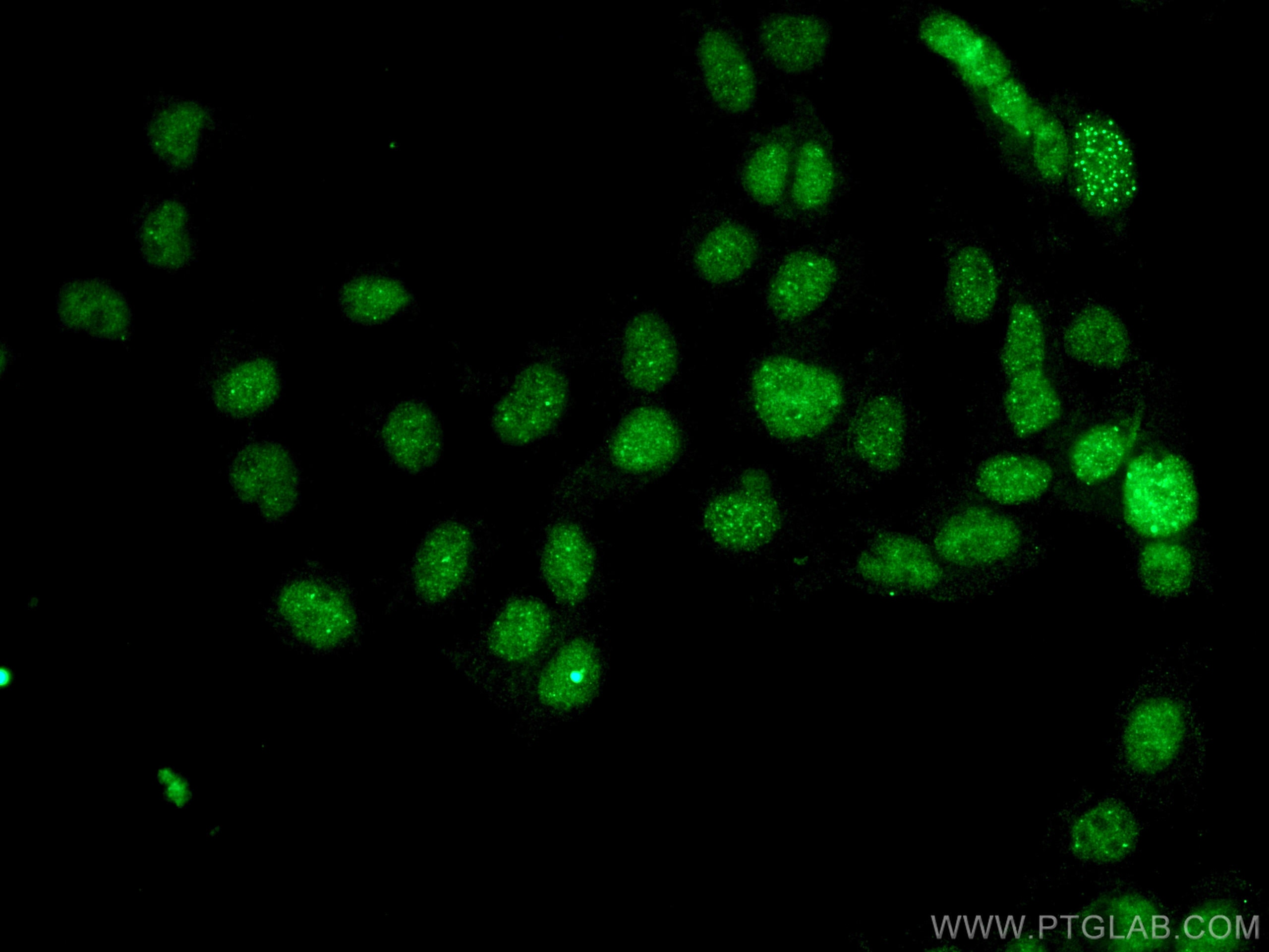 Immunofluorescence (IF) / fluorescent staining of A431 cells using DAXX Monoclonal antibody (67879-1-Ig)