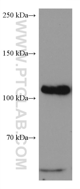 Western Blot (WB) analysis of HeLa cells using DAXX Monoclonal antibody (67879-1-Ig)