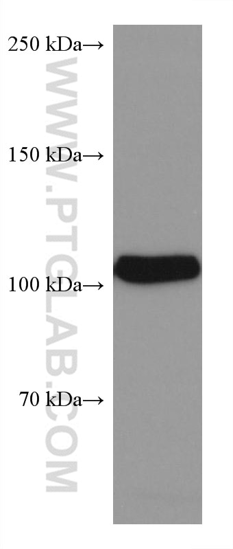 Western Blot (WB) analysis of Jurkat cells using DAXX Monoclonal antibody (67879-1-Ig)