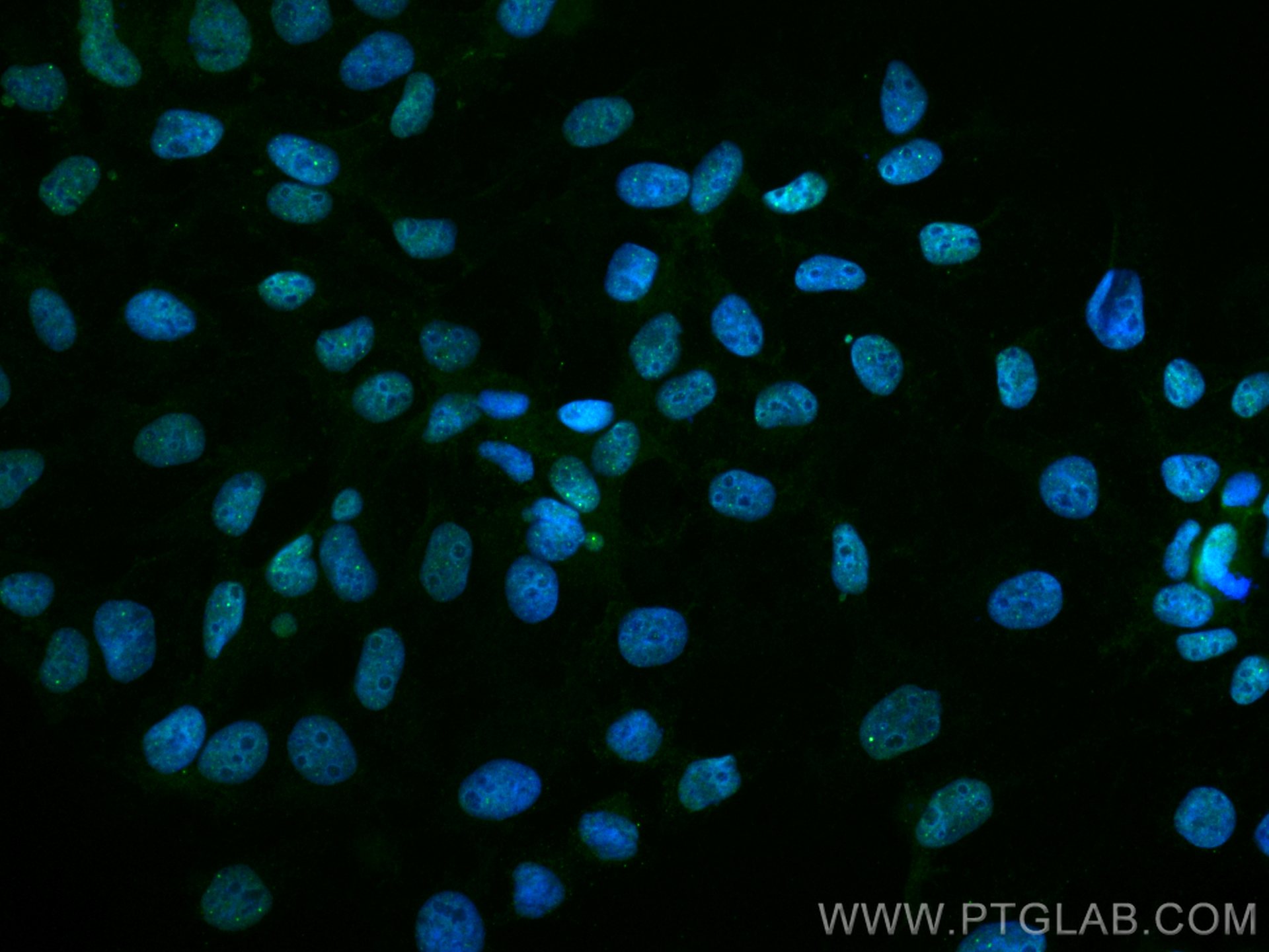 Immunofluorescence (IF) / fluorescent staining of A431 cells using CoraLite® Plus 488-conjugated DAXX Monoclonal anti (CL488-67879)