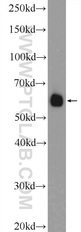 Western Blot (WB) analysis of mouse testis tissue using DAZ4 Polyclonal antibody (14065-1-AP)